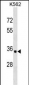 OR10AD1 Antibody (Center)